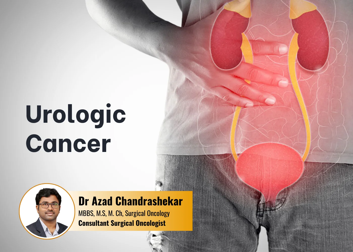 Best urologic-cancer in Hyderabad